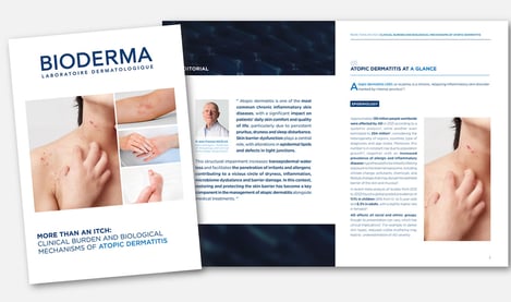 Thumbnail of scientific article on atopy written with Prof. Nicolas