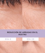 Resultados antes y después de usar Bakuchiol