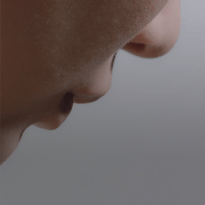 wound healing skin image