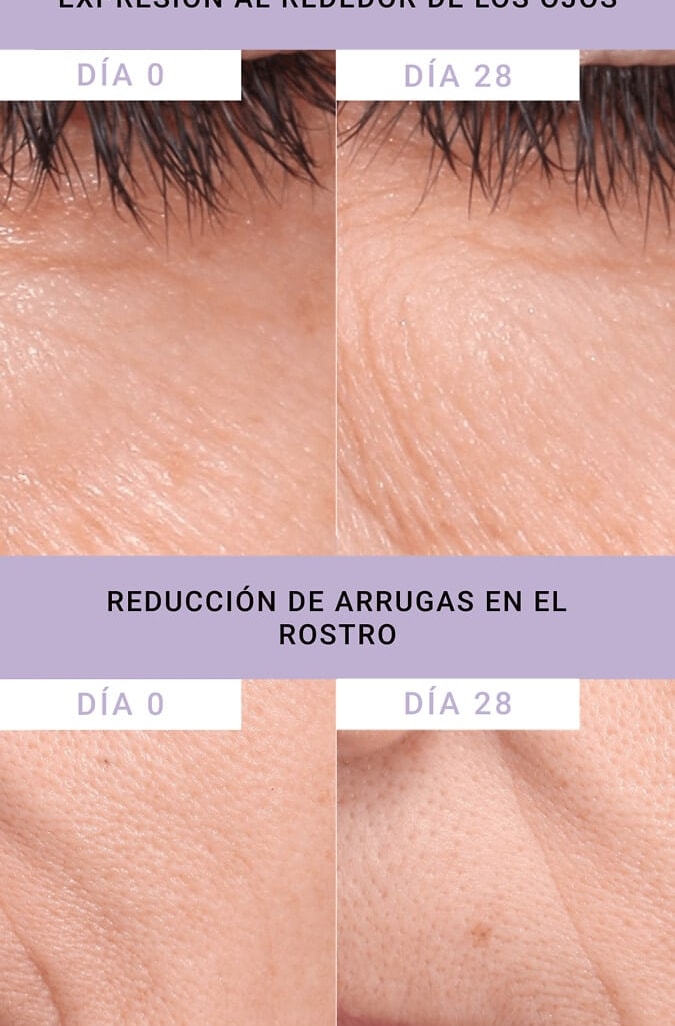 Resultados antes y después de usar Bakuchiol